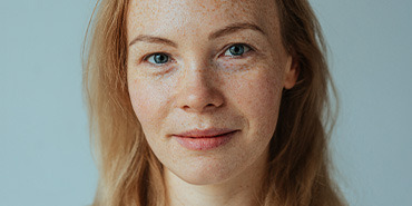 LES HORMONES ET LA PEAU : COMMENT L'ACNE HORMONALE PEUT AFFECTER LES FEMMES A DIFFERENTES ETAPES DE LEUR VIE ?